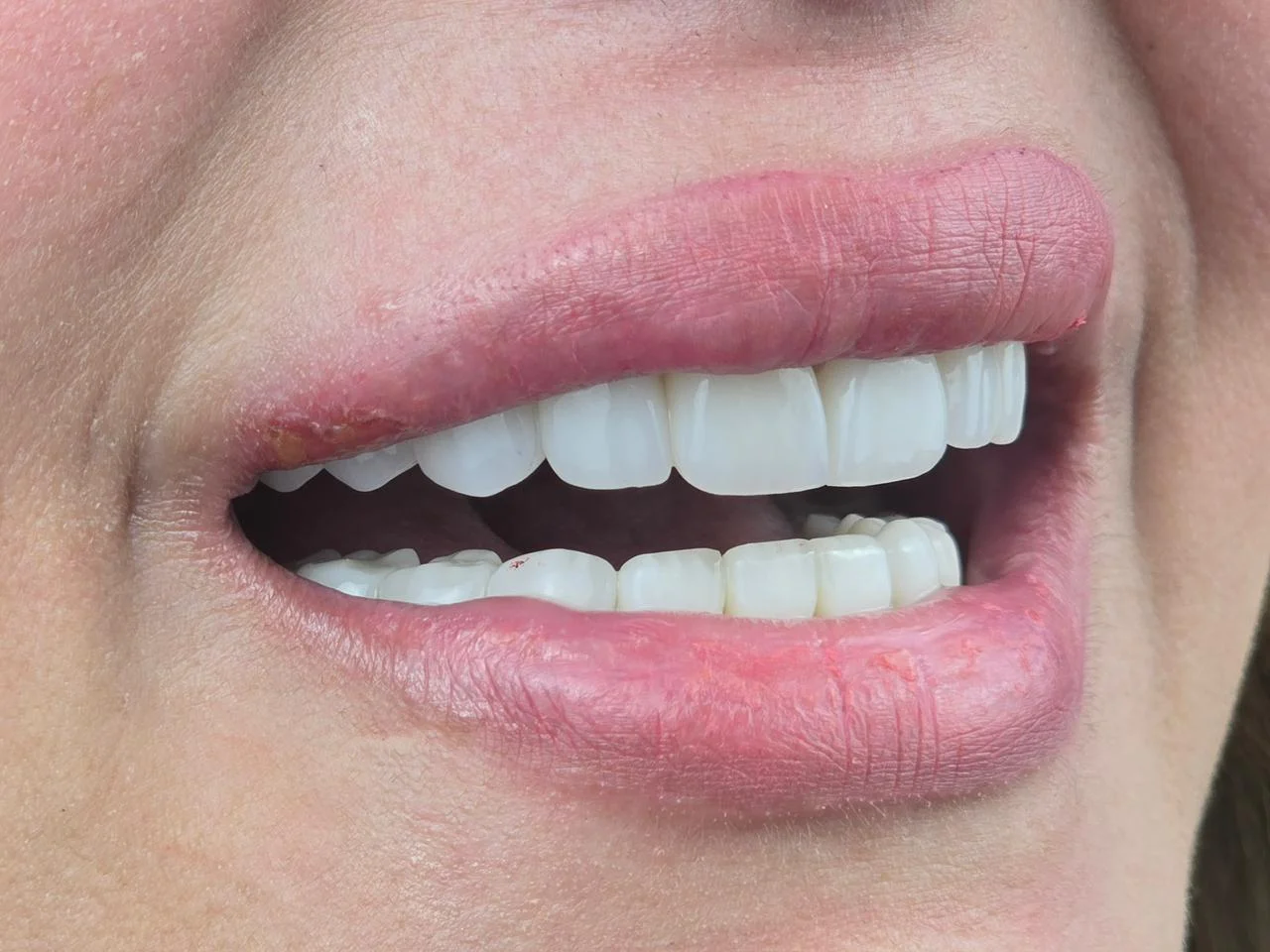 تركيب اسنان (17)